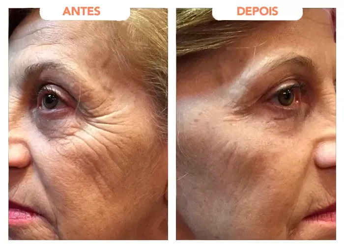 Relato de cliente sobre o Trans Resveratrol