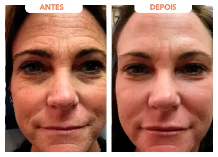 Terceiro relato de cliente sobre o Trans Resveratrol