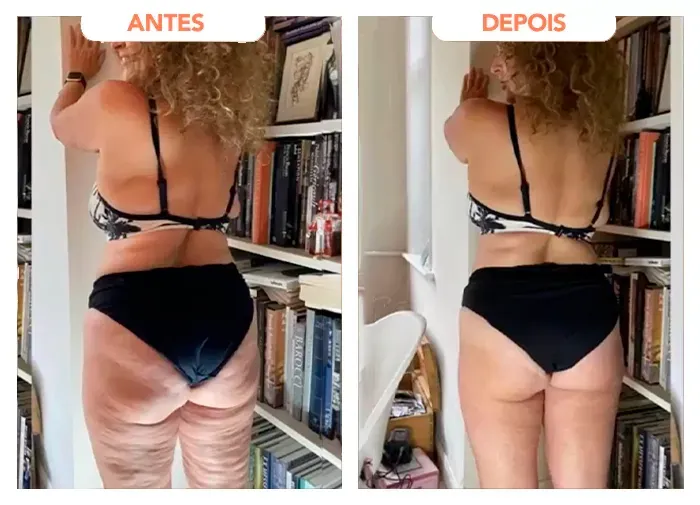 Quarto relato de cliente sobre o Trans Resveratrol